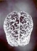 lannybrains